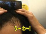 宮迫ハゲ2