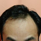 �ץ��ڥ����θ�155����