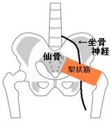 梨状筋