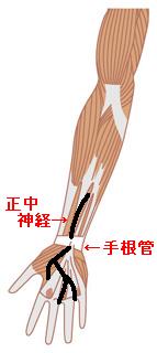 �꺬��