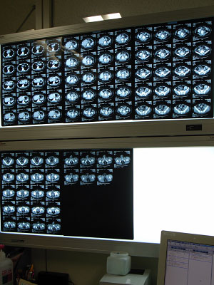 CT�̿� 1