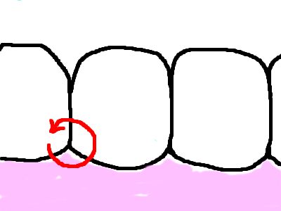 歯ブラシ4
