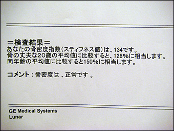 Bone Density