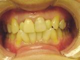 e0471c93.jpg
