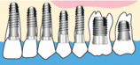 d13b7f12.gif