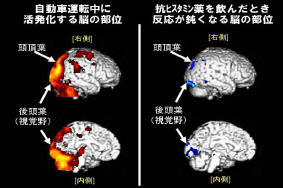 花粉症治療薬・鎮静性抗ヒスタミン薬