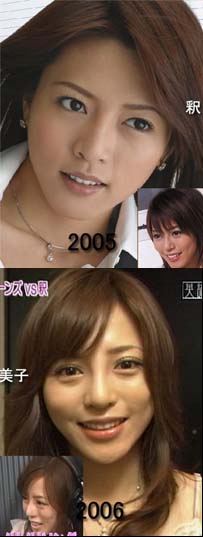 釈由美子 整形