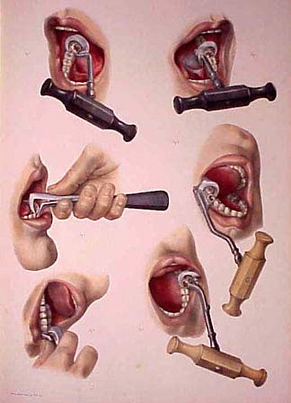 Dentalkeyusage