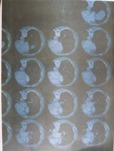 4�T�Ԍ��CT�摜