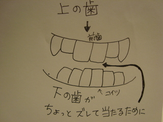歯