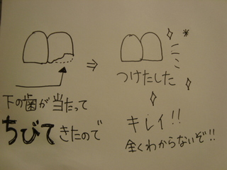 歯
