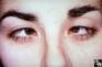 abducens palsy