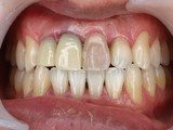 PB050474