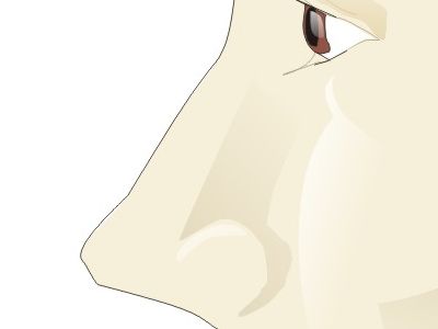 ɡ00