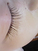 200911182