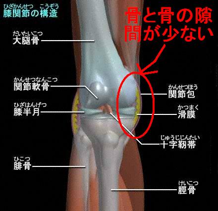 「膝の内側の痛み 原因」の画像検索結果