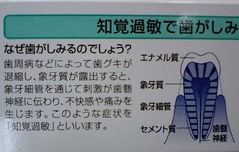 知覚過敏3