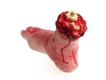 stump-4