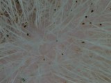 正八にきび*50その2