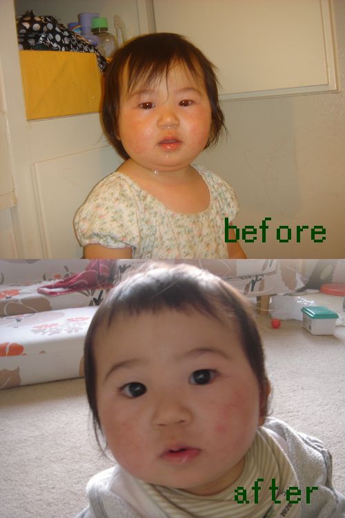before after