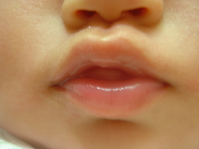 LOVELY LIP