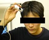 頭皮写真１