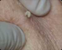 ������