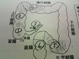 2006/6/29内視鏡