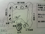 2007/1/19内視鏡2