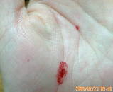 blood