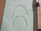 矯正用ワイヤー