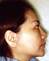 200211a