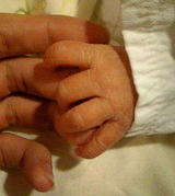 hand
