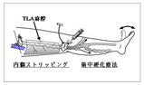 ストリッピング