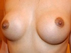 125